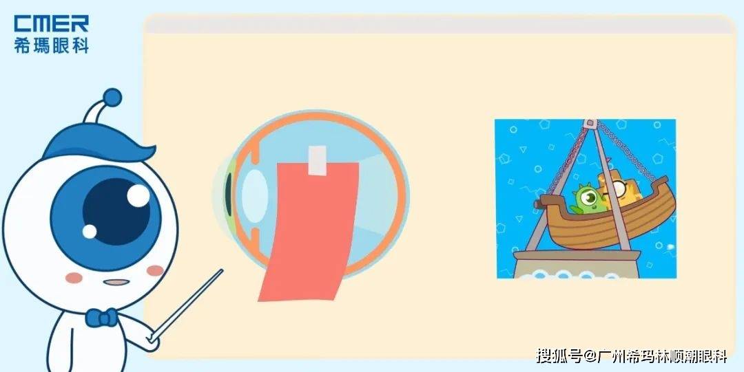 吓坏！女子近视3000度，被迫摘除眼球！