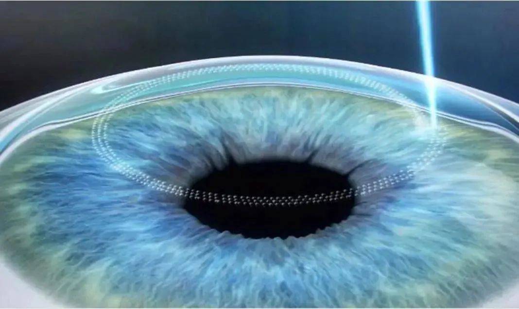 广州眼科近视手术医院哪家最好?前10排行TOP榜单,2025年版来了~