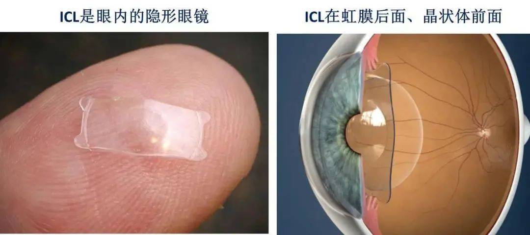 徐州近视眼科医院?排行榜top10公开一览2025年~