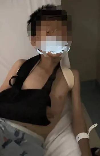 赤峰市教育局介入,家长称:孩子拨弄开关被另一班班主任打伤 赤峰市教育局介入,家长称:孩子拨弄开关被另一班班主任打伤