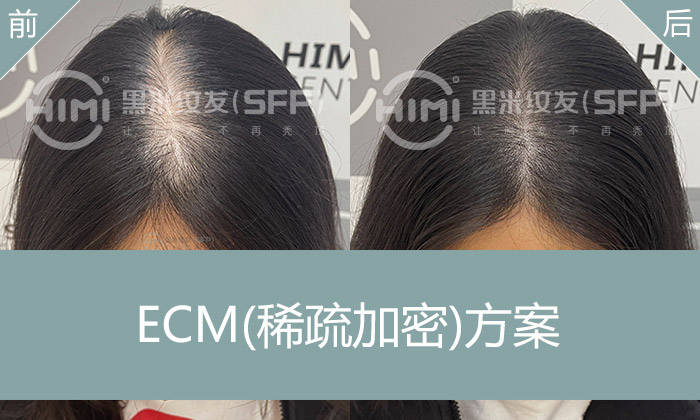 女生发缝宽适合做纹发吗？发缝惊喜大改变