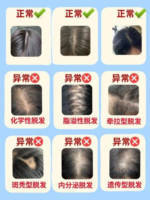 国货最好的生发产品是哪一种？这几款效果最牛了，推荐