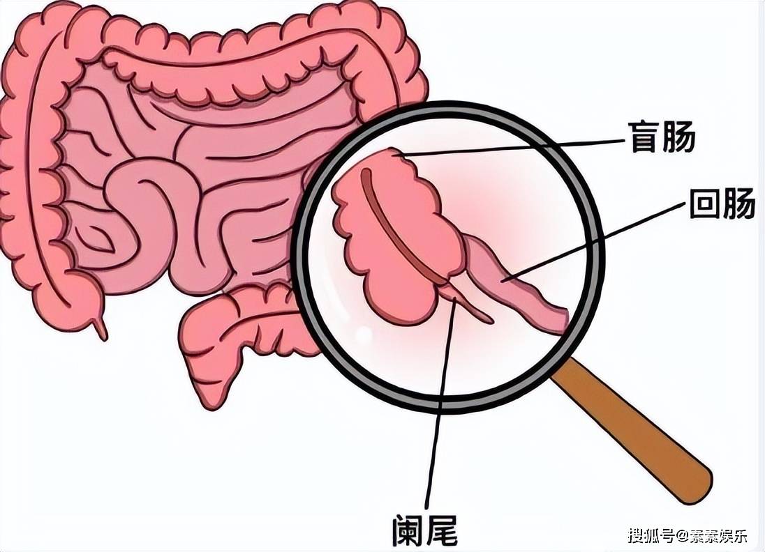 原创              陈乔恩确诊盲肠炎，手术在肚子上打3个洞，切除部位令人心疼