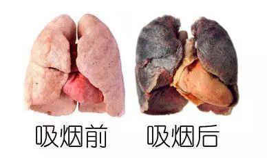 奥林老师给你讲讲，五脏六腑都怕什么？如何针对排毒