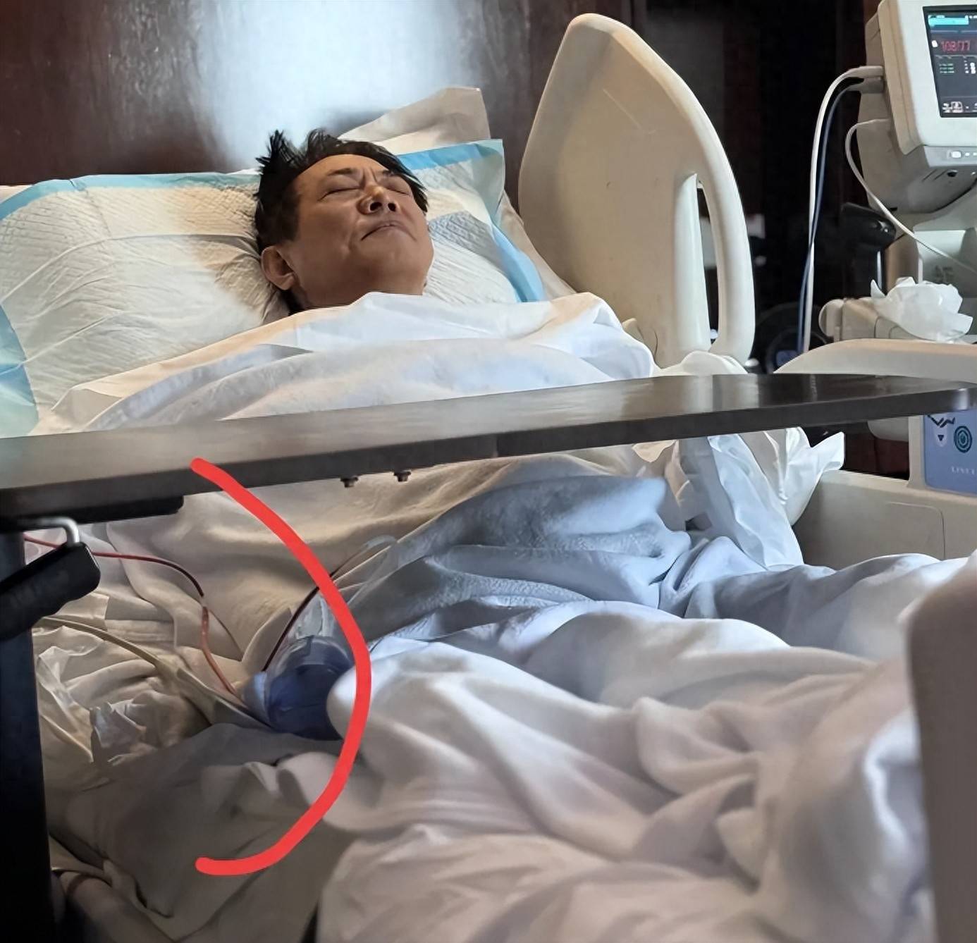 李连杰手术过程曝光价值两亿佛珠不离手，报平安才肯摘下，网友评论一针见血
