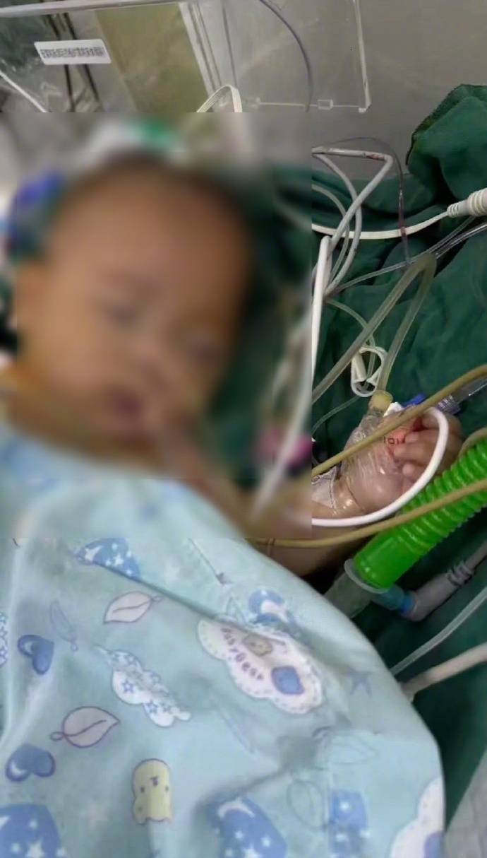 “属于比较重大的医疗纠纷”，5月龄女婴心脏手术离世：涉事医生已停诊 曾做罕见手术