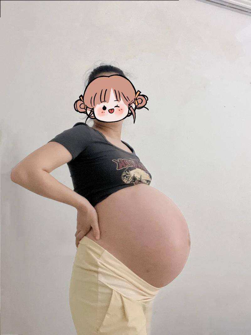 为什么越来越多孕妈选择剖腹产?妇产科医生:被6个谣言误导