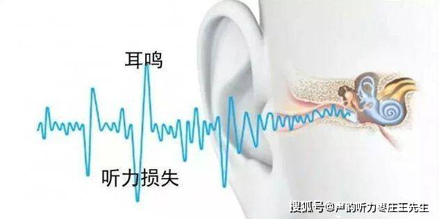 为什么有听损就建议尽早配助听器呢?