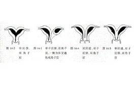 单角子宫、双角子宫…盘点7种畸形子宫！(图1)