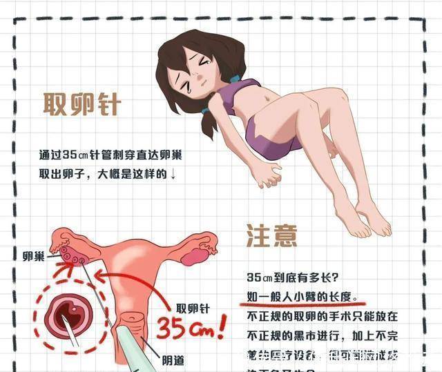 广州生殖医学中的供卵试管技术:现状与前景 广州生殖医学中的供卵试管技术:现状与前景