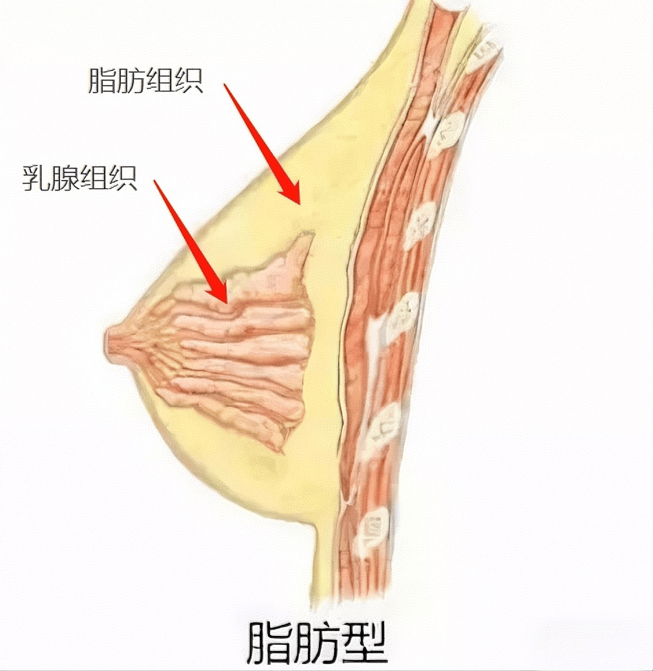 女性胸部摸起来什么手感?我的感觉好像不太对.....