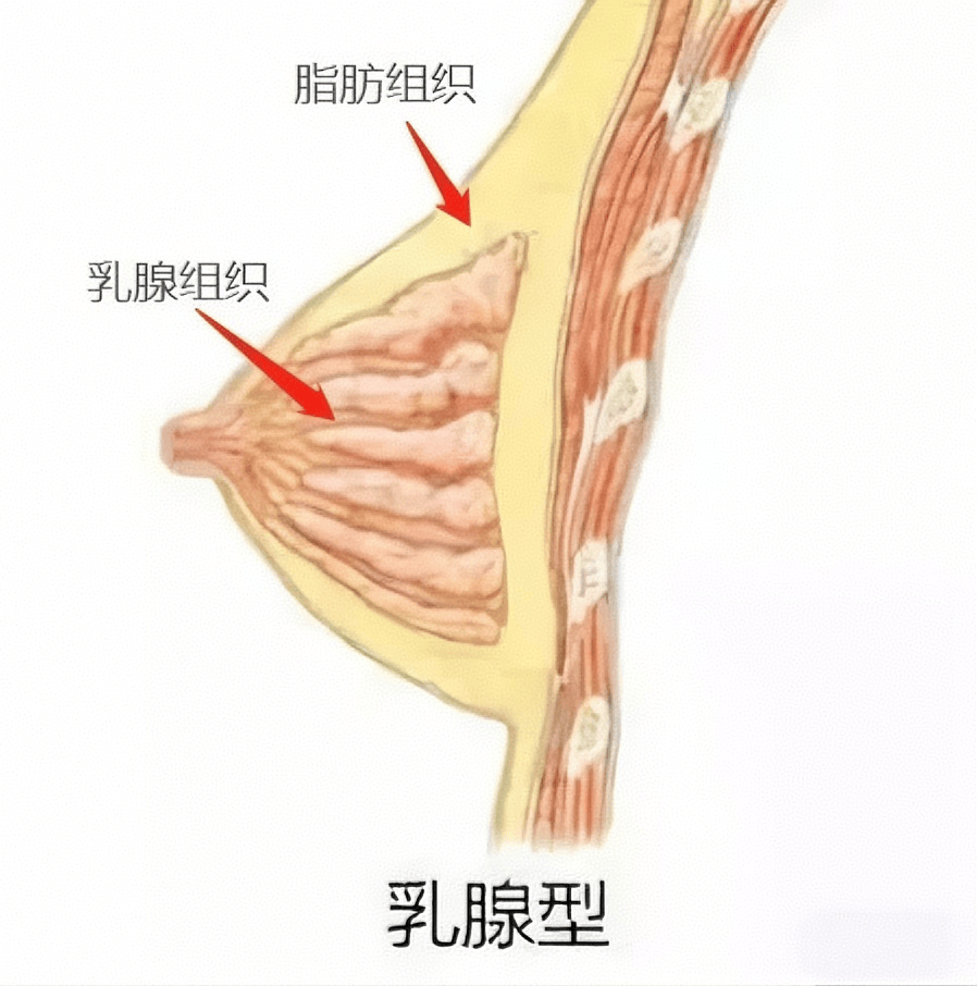 女性胸部摸起来什么手感?我的感觉好像不太对.....