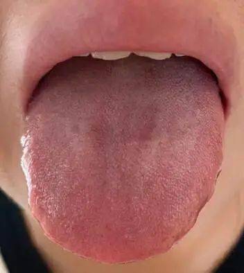 焦虑失眠多梦，负能量太重，如何食养调理？