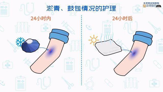 告别采血前紧张！动画带诸位解锁静脉采血 “无忧攻略”