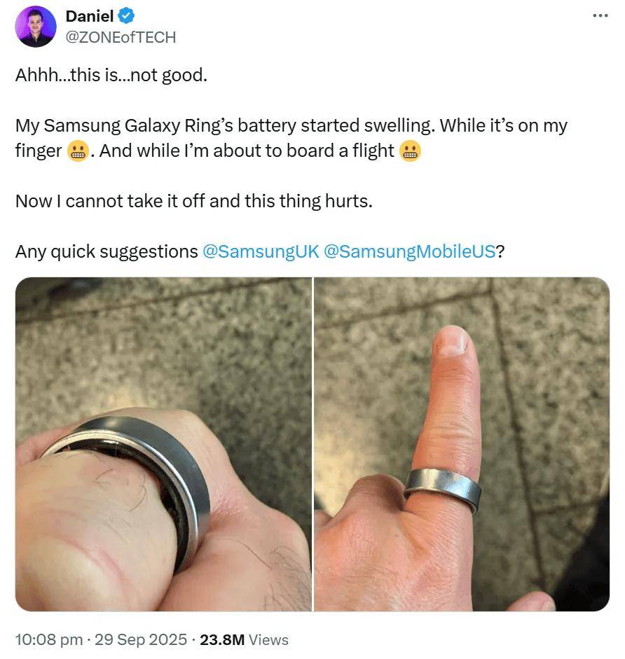 ¥3000的“电子废物”突然抽风，差点把手指勒淤血，戴这个的都什么人？