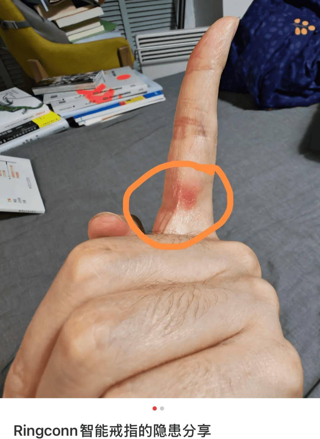 ¥3000的“电子废物”突然抽风，差点把手指勒淤血，戴这个的都什么人？