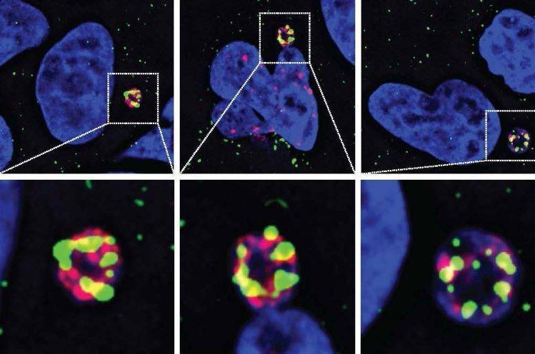 破解十年谜题:科学家首次破解癌症耐药性谜题,锁定染色体碎裂“元凶”