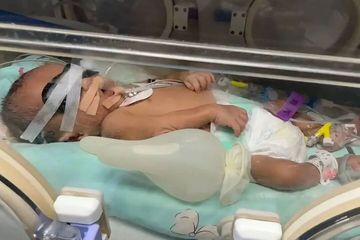 江西省妇幼保健院早产儿因病情危重离世：患儿家