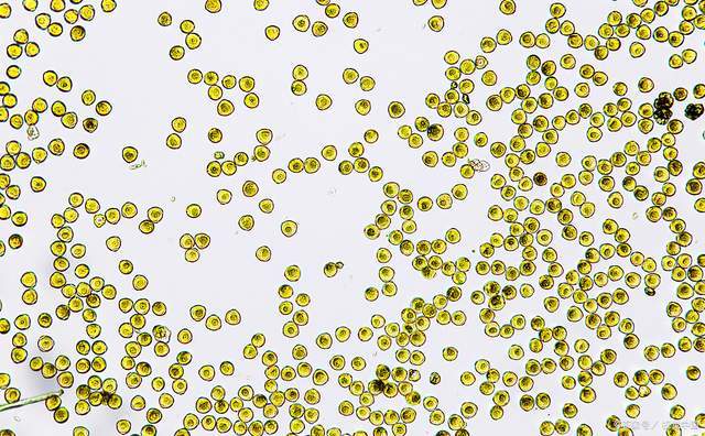 革兰染色葡萄球菌图片