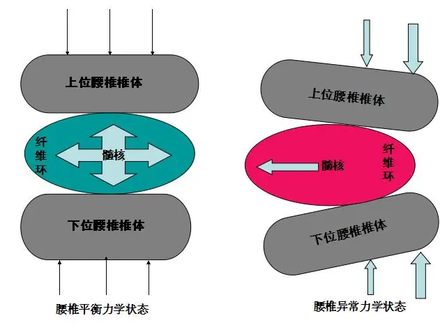 椎板间隙图片