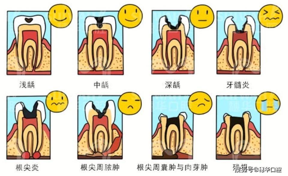 治療_進行_嚴重