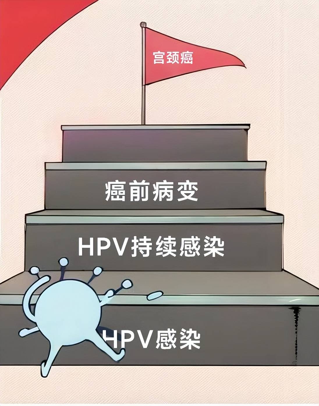 北京和平结合医院hpv科闫会宁主任专项讲解:hpv感染多久才会病变?