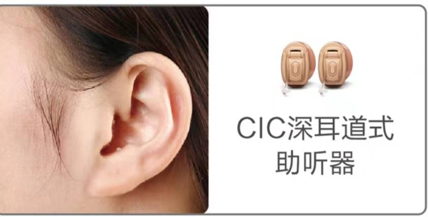 助听器按外形如何分类?_耳道_体积_功率