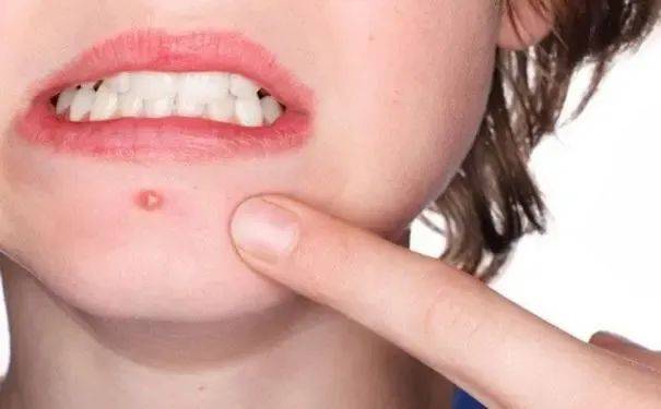 摄入量_研究_吃盐