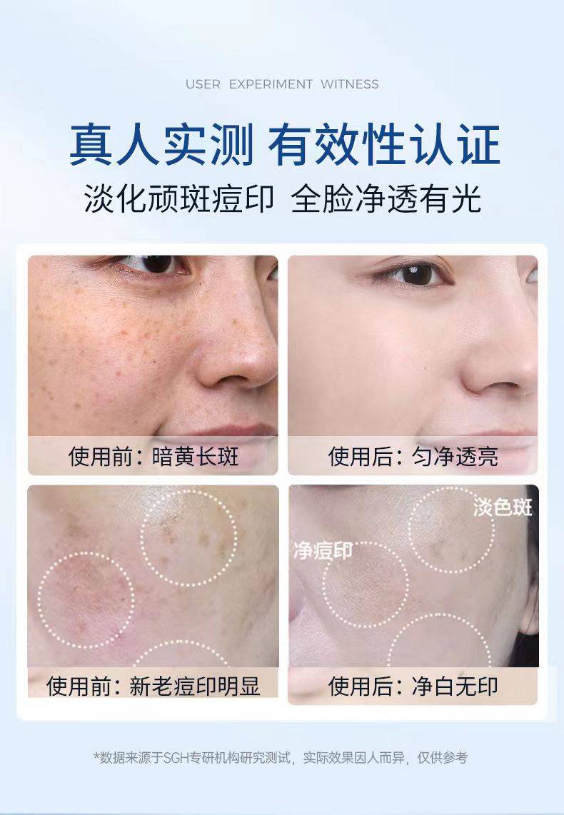 淡斑效果好的护肤品,祛斑美白还得看它!_肌肤_斑点_产品