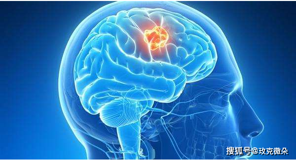 眩晕,感觉/运动障碍等问题,这是因为癌症所导致的视乳头水肿造成的