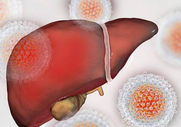 肝变硬,头先知?