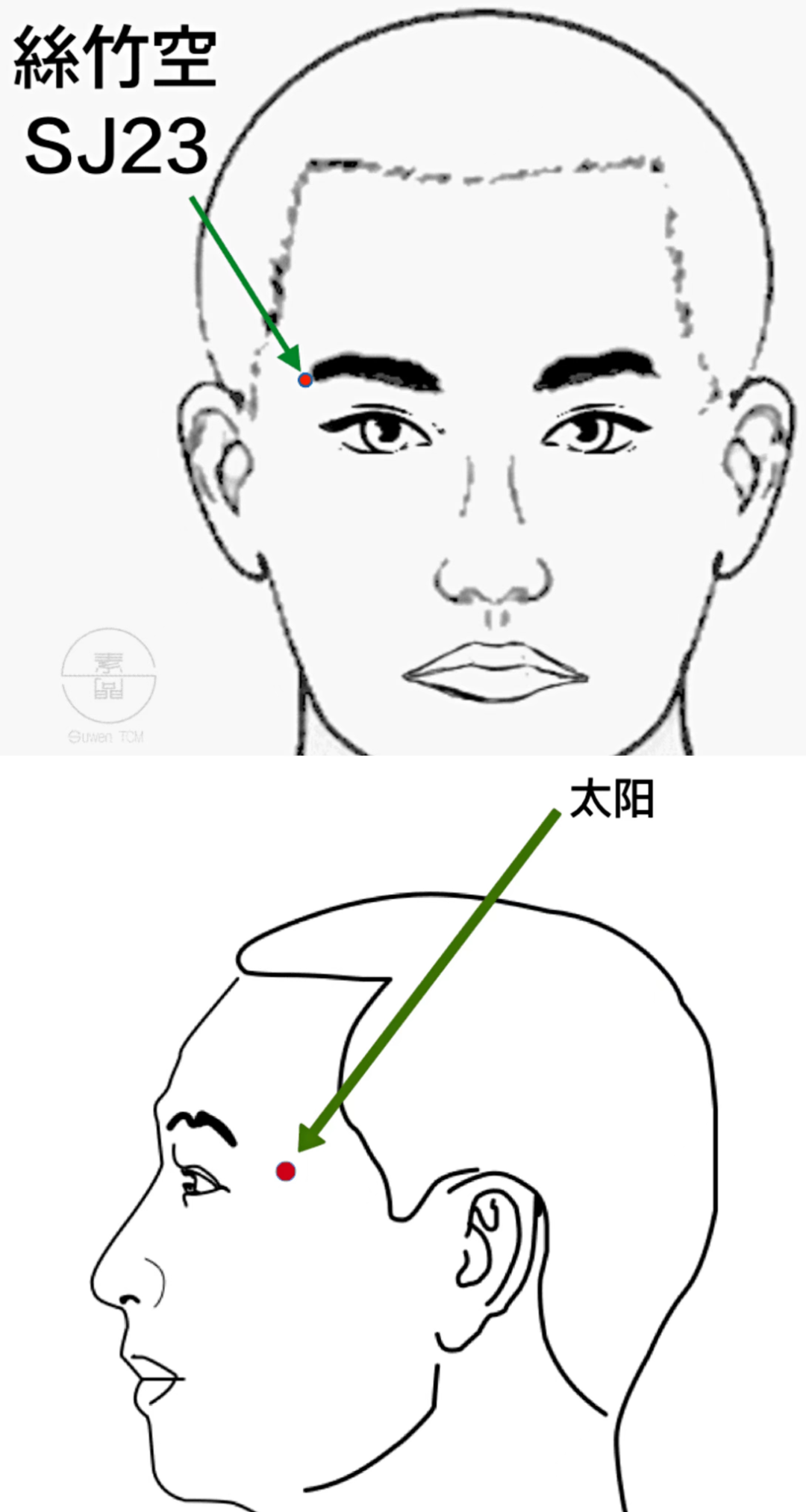 來源:孫培榮用於治療偏頭痛,先在對側合谷下針有麻醉效果,再配