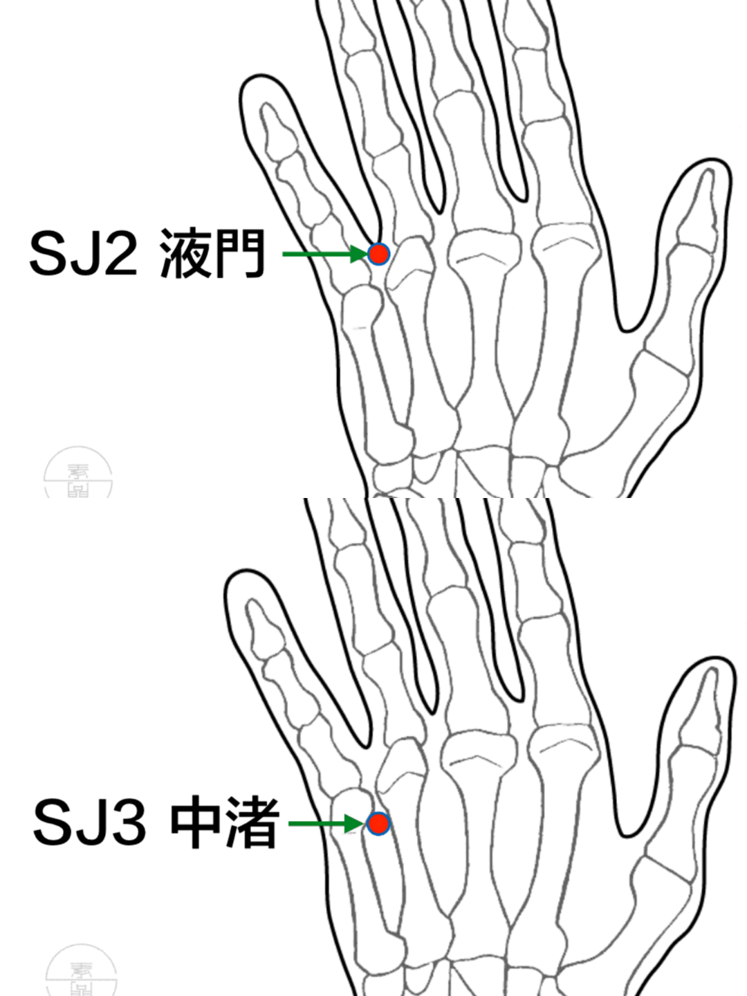 液門透中渚來源:孫培榮用於治療痴呆證,再配四神聰,百會,印堂,風池