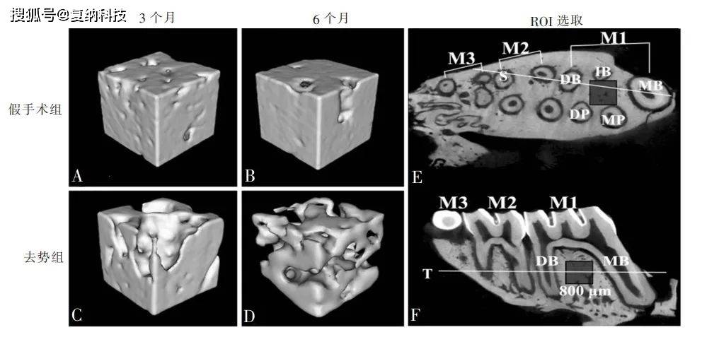 顯微ct 無損成像技術在牙科研究中的應用_組織_測量