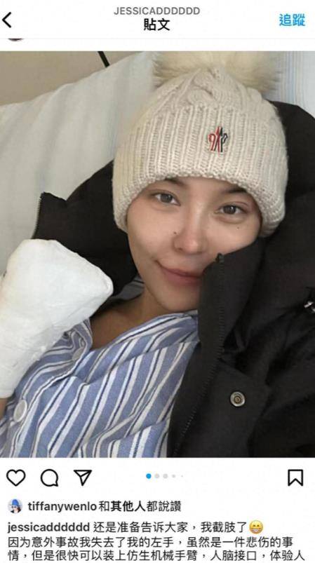 网红杜颜嘉出事故致左手截肢,病床照曝光,曾与洪金宝儿子传绯闻_勇气