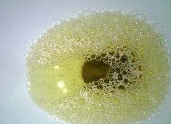 泡沫尿的判断标准图片
