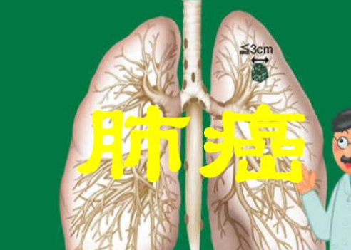 肺癌早期症状图片