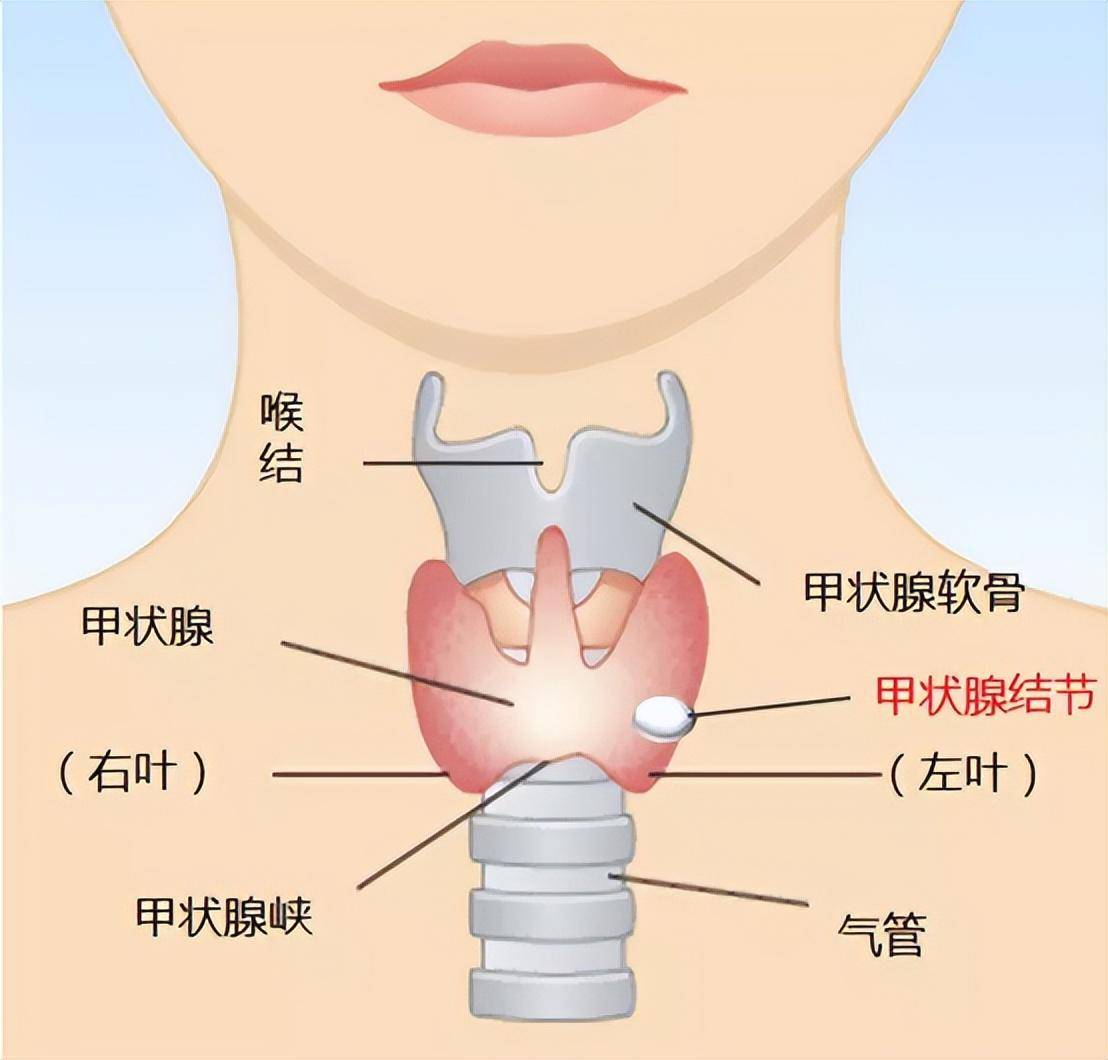 甲状腺为何结节?什么原因引起的?做好早期筛查