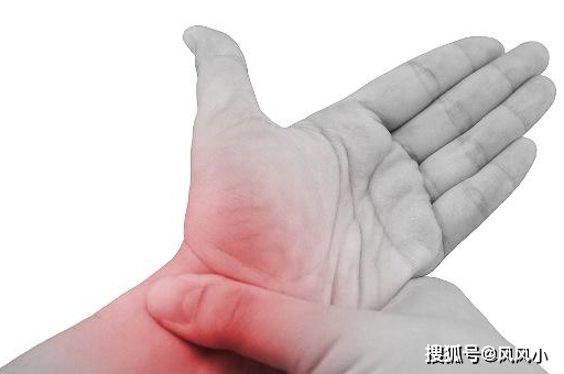 譬如长时间用鼠标或打字的话,就可能造成腕管综合征,主要表现为大拇指