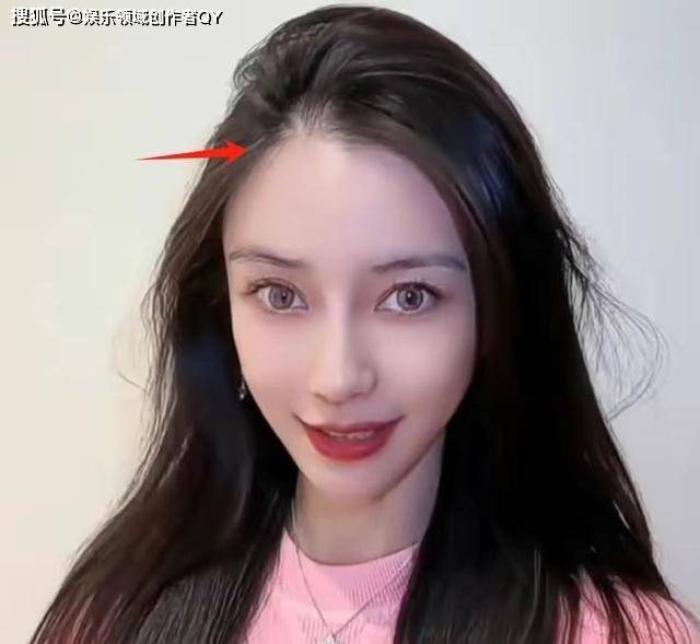 杨颖风波后首露面,暴廋脸颊凹陷,头发稀松出油太邋遢