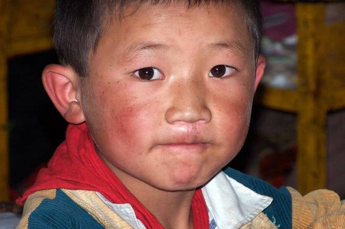 看看身边那些脸蛋干干红红的宝宝吧,颜值比起没出现"高原红"时明显