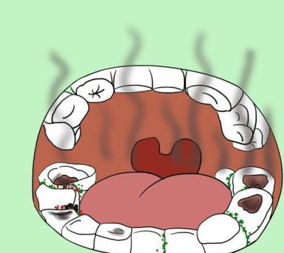 是什么原因导致孩子口臭?你家孩子有吗_口腔_宝宝_补充