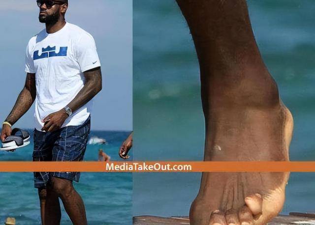 揭秘nba亿万富豪透支身体赚钱的代价,5张照片让你深刻