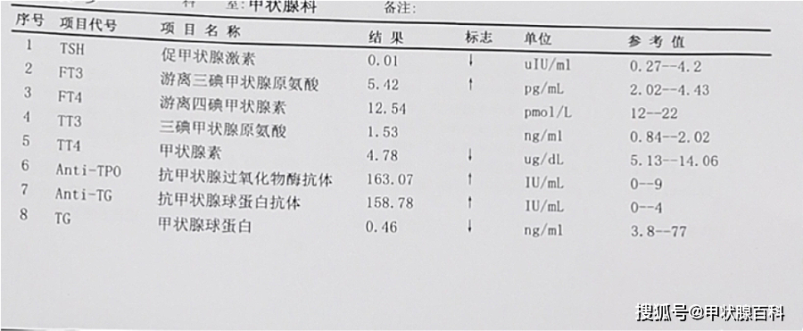 甲状腺细胞受损,存储在甲状腺细胞内部的甲状腺激素,甲状腺过氧化物酶