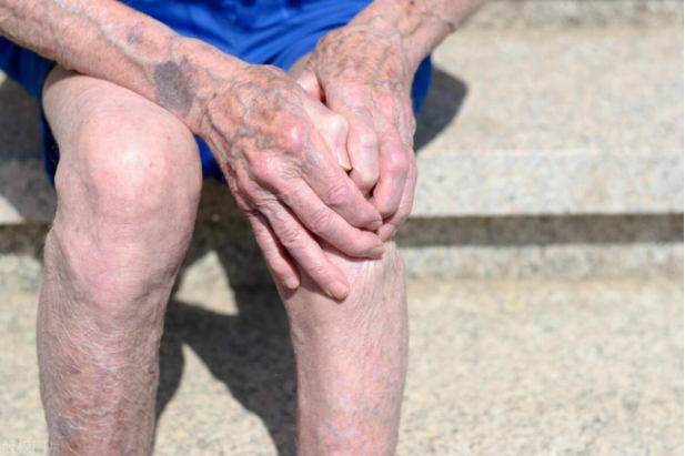 冻出老寒腿?其实寒冷并非病因,而是加重症状的因素_关节_气温_肌肉
