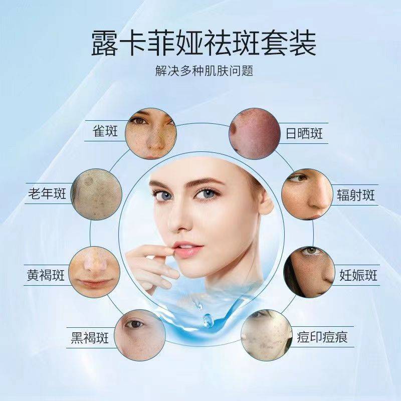 十大美白祛斑排行榜,淡斑效果好的护肤品_斑点_成分_肌肤