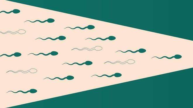 原来精子出行路被"拦路虎"阻断!_输精管_检查_睾丸