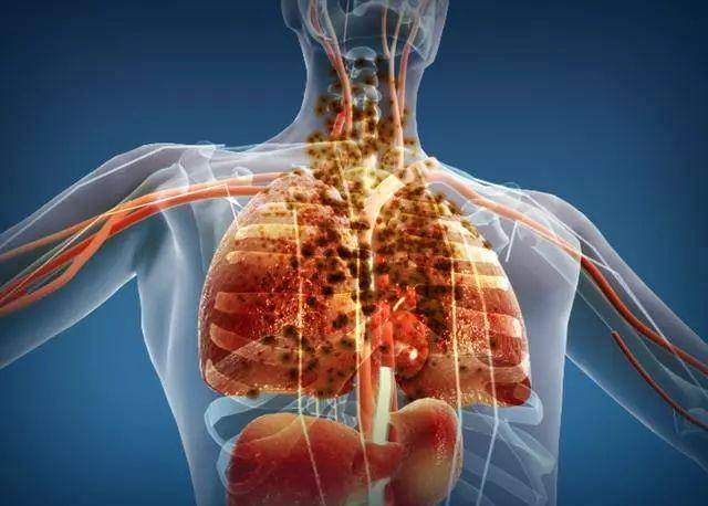 肺疼是什么原因肺部图片