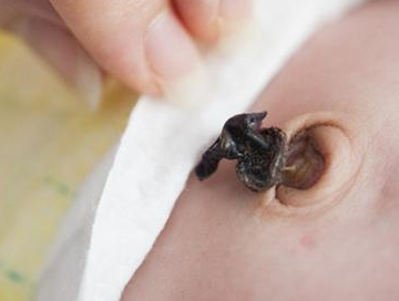 出生后4-7天,新生儿的脐带会自动脱落.