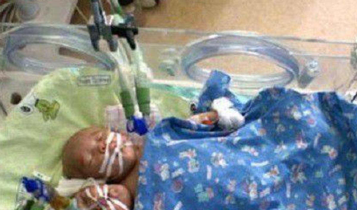 2011年,四川孕妇生下中国第一例"双头女婴",最后怎样了?